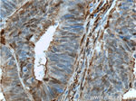 Gelsolin Antibody in Immunohistochemistry (Paraffin) (IHC (P))