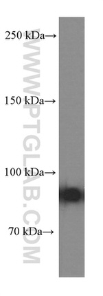 Gelsolin Antibody in Western Blot (WB)