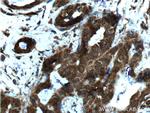 YY1 Antibody in Immunohistochemistry (Paraffin) (IHC (P))