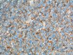 CD200 Antibody in Immunohistochemistry (Paraffin) (IHC (P))