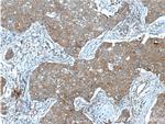 IGF1R beta chain Antibody in Immunohistochemistry (Paraffin) (IHC (P))