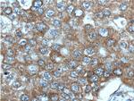 IGF1R beta chain Antibody in Immunohistochemistry (Paraffin) (IHC (P))