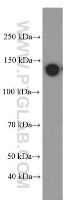 IGF1R beta chain Antibody in Western Blot (WB)