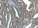 IGF1R beta chain Antibody in Immunohistochemistry (Paraffin) (IHC (P))