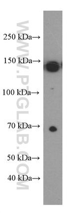 IGF1R beta chain Antibody in Western Blot (WB)