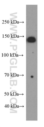 IGF1R beta chain Antibody in Western Blot (WB)