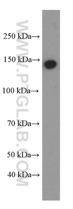 IGF1R beta chain Antibody in Western Blot (WB)