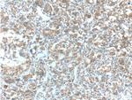 LDHA Antibody in Immunohistochemistry (Paraffin) (IHC (P))