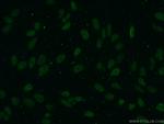 Pan Acetylation Antibody in Immunocytochemistry (ICC/IF)