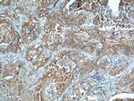 GLUT1 Antibody in Immunohistochemistry (Paraffin) (IHC (P))