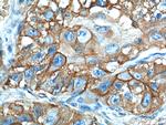 GLUT1 Antibody in Immunohistochemistry (Paraffin) (IHC (P))