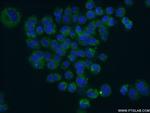 BDNF Antibody in Immunocytochemistry (ICC/IF)