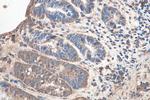 SETDB1 Antibody in Immunohistochemistry (Paraffin) (IHC (P))