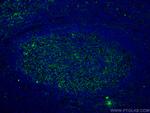 VCAM-1 Antibody in Immunohistochemistry (PFA fixed) (IHC (PFA))