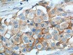 VCAM-1 Antibody in Immunohistochemistry (Paraffin) (IHC (P))