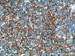 VCAM-1 Antibody in Immunohistochemistry (Paraffin) (IHC (P))