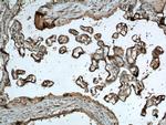 P-cadherin Antibody in Immunohistochemistry (Paraffin) (IHC (P))