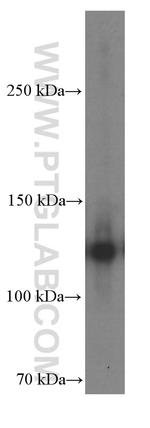 P-cadherin Antibody in Western Blot (WB)