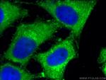 Sestrin2 Antibody in Immunocytochemistry (ICC/IF)