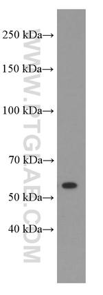 Sestrin2 Antibody in Western Blot (WB)