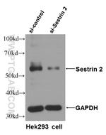 Sestrin2 Antibody in Western Blot (WB)