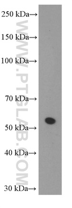 Sestrin2 Antibody in Western Blot (WB)