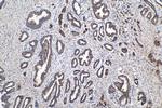 FABP5 Antibody in Immunohistochemistry (Paraffin) (IHC (P))