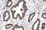 FABP5 Antibody in Immunohistochemistry (Paraffin) (IHC (P))