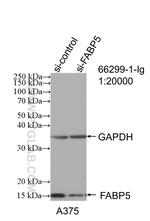 FABP5 Antibody in Western Blot (WB)