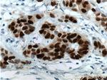 PR Antibody in Immunohistochemistry (Paraffin) (IHC (P))