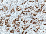 PR Antibody in Immunohistochemistry (Paraffin) (IHC (P))