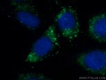 LAMP2 Antibody in Immunocytochemistry (ICC/IF)