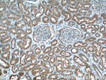 LAMP2 Antibody in Immunohistochemistry (Paraffin) (IHC (P))