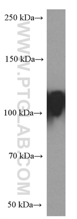 LAMP2 Antibody in Western Blot (WB)