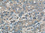 CHCHD2 Antibody in Immunohistochemistry (Paraffin) (IHC (P))