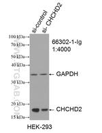 CHCHD2 Antibody in Western Blot (WB)