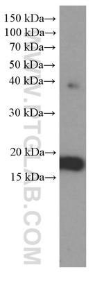 CHCHD2 Antibody in Western Blot (WB)