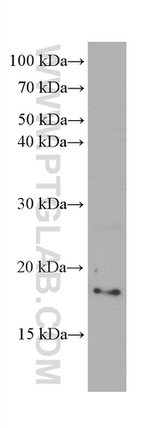 CHCHD2 Antibody in Western Blot (WB)