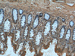 TBL2 Antibody in Immunohistochemistry (Paraffin) (IHC (P))