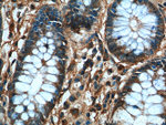 TBL2 Antibody in Immunohistochemistry (Paraffin) (IHC (P))