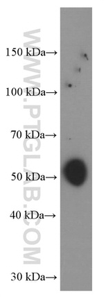 TBL2 Antibody in Western Blot (WB)