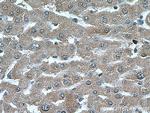 PEX5 Antibody in Immunohistochemistry (Paraffin) (IHC (P))