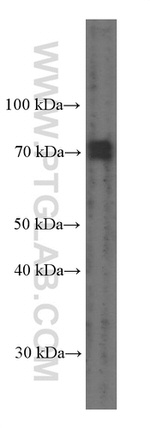 PEX5 Antibody in Western Blot (WB)