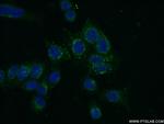 TRAF3 Antibody in Immunocytochemistry (ICC/IF)