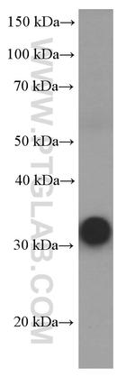 RSPO3 Antibody in Western Blot (WB)