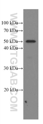 Phospho-TDP43 (Ser409, Ser410) Antibody in Western Blot (WB)