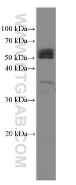 Phospho-TDP43 (Ser409, Ser410) Antibody in Western Blot (WB)