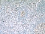 IL21R Antibody in Immunohistochemistry (Paraffin) (IHC (P))