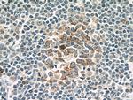 IL21R Antibody in Immunohistochemistry (Paraffin) (IHC (P))