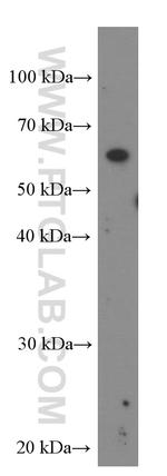 IL21R Antibody in Western Blot (WB)